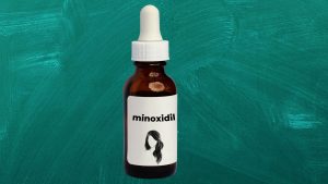 minoxidil for hair loss
