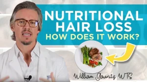 Nutritional Hair Loss – How Does It Work?